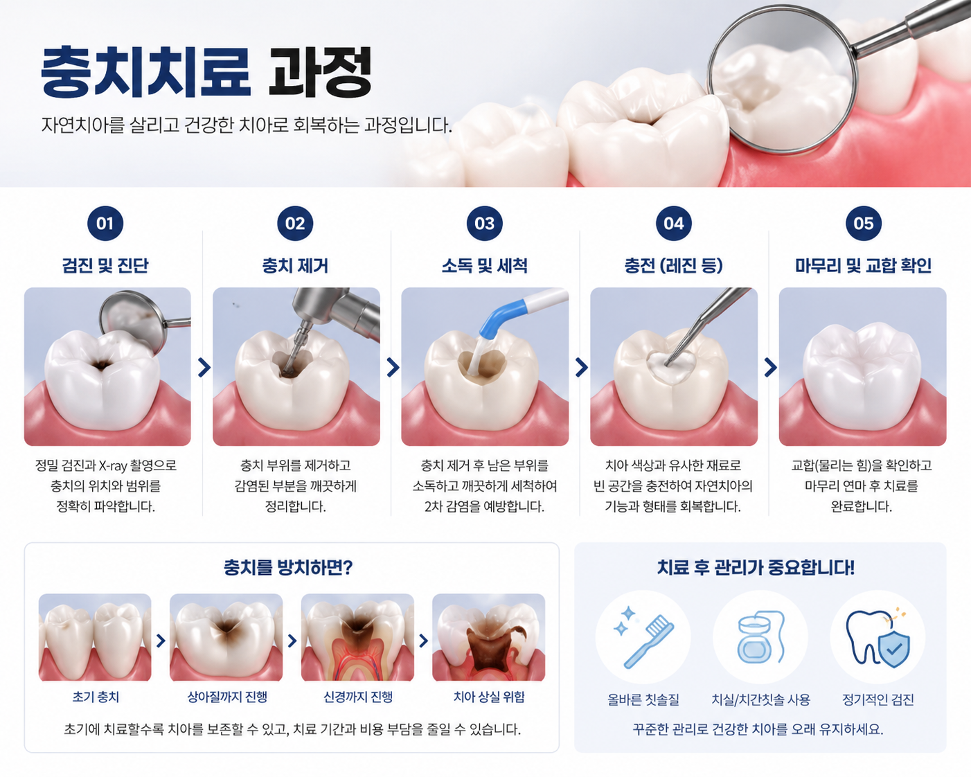 평택 충치치료 단계별 치과보존과 전문의 연세꿈꾸는치과 평택지제점